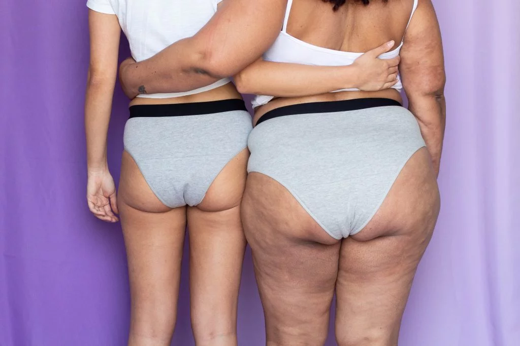 Amigas se abraçando usando calcinhas menstruais, alternativas sustentáveis aos tradicionais absorventes