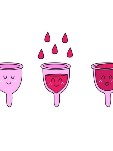 fluxo menstrual intenso inciclo