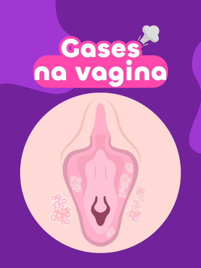 Gases na vagina: é normal? Como evitar?