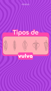 Os tipos de vulva